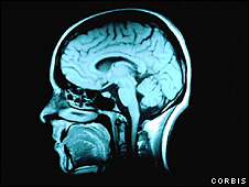 Brain scan