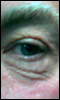 Matthew Bannister's eye
