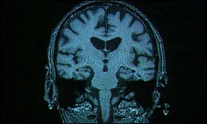 Brain scan