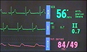 heart monitor