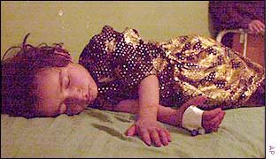 Afghan child brought to Kandahar hospital