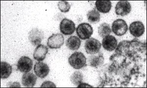 HIV