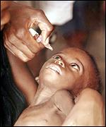 Polio vaccine