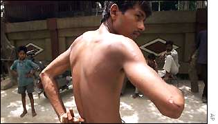 A man shows scratches on his body after being attacked by the mysterious monkey-man in Delhi last year.   