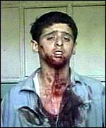 Blast victim