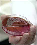 e-coli bacteria