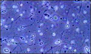 sperm