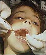 Child's teeth
