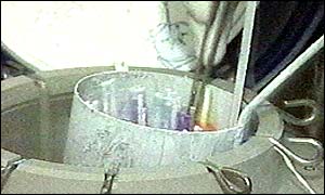 IVF