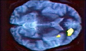 Brain image