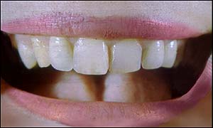Mouth