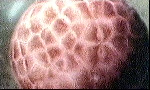 Early embryo