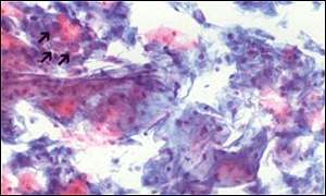 Smear test slide