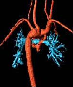 Heart image