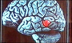 Brain image