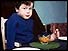 Child victim of Thalidomide