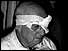Man with bandage round head 