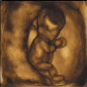 10 weeks gestation, 6cm from crown to rump.