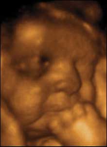 26 weeks gestation. 23cm from crown to rump.