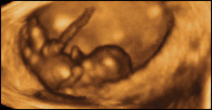Eight weeks gestation, 40mm from crown to rump.