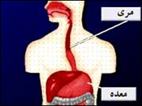  التهاب مری