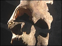 Skull