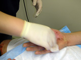 Nurse treating patient