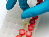 Doping tests