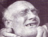 Long before the days of political correctness, Thomas Murphy, rather than  'follicly and dentally challenged', was described as being 'very bald with very bad teeth'.