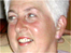 Anne