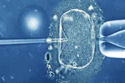 IVF