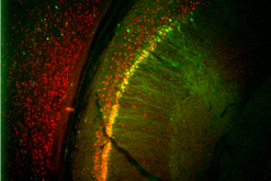 interneuron: slide of the brain
