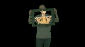 X-Ray