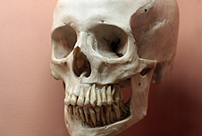 A skull