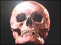 skull