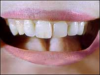 Mouth
