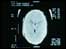 X ray