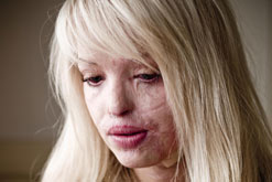 Katie Piper