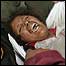 Mulher chega ferida ao hospital de Ica, peru