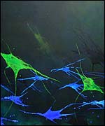 Pic:  Nuerons, sensory , from a series by Pam Winbolt .