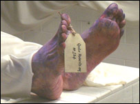 Body in a morgue