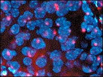 Células pancreáticas