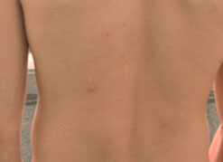 Backs