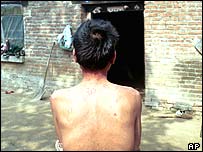 Chinês contaminado com Aids