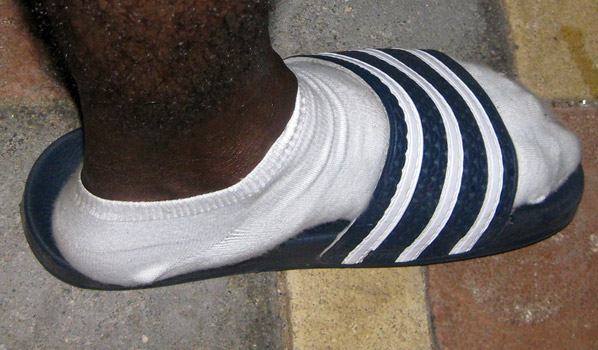 Twin B's foot