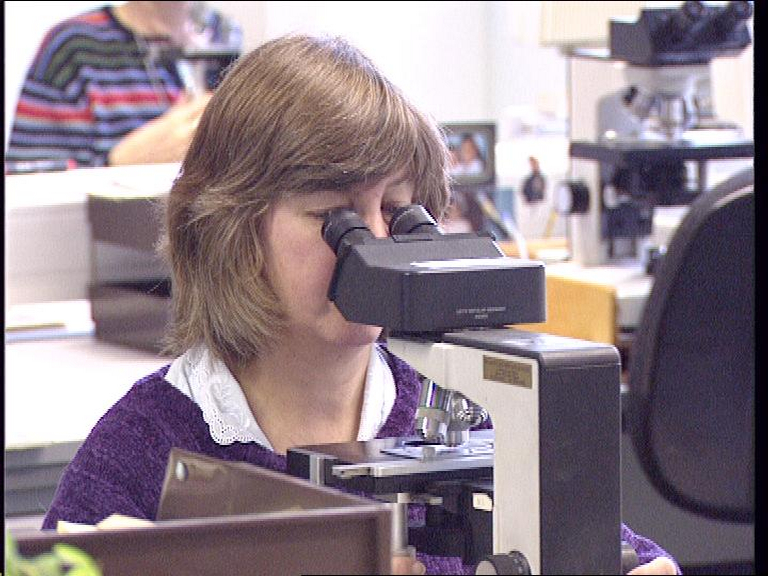 cervical cancer screening