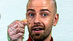 Chris holding a plaster