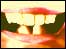open mouth