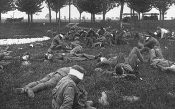 Gas attack
