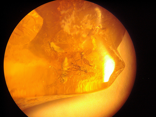 Amber